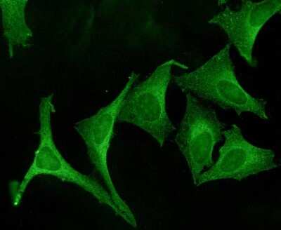 Immunocytochemistry/Immunofluorescence: Calnexin Antibody [NBP2-12724] - Immunocytochemistry/Immunofluorescence analysis using Rabbit Anti-Calnexin Polyclonal Antibody (NBP2-12724). Tissue: Cervical cancer cell line (HeLa). Species: Human. Primary Antibody: Rabbit Anti-Calnexin Polyclonal Antibody (NBP2-12724) at 1:100. Secondary Antibody: FITC Goat Anti-Rabbit (green).